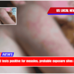 Virginia child tests positive for measles; probable exposure sites are provided